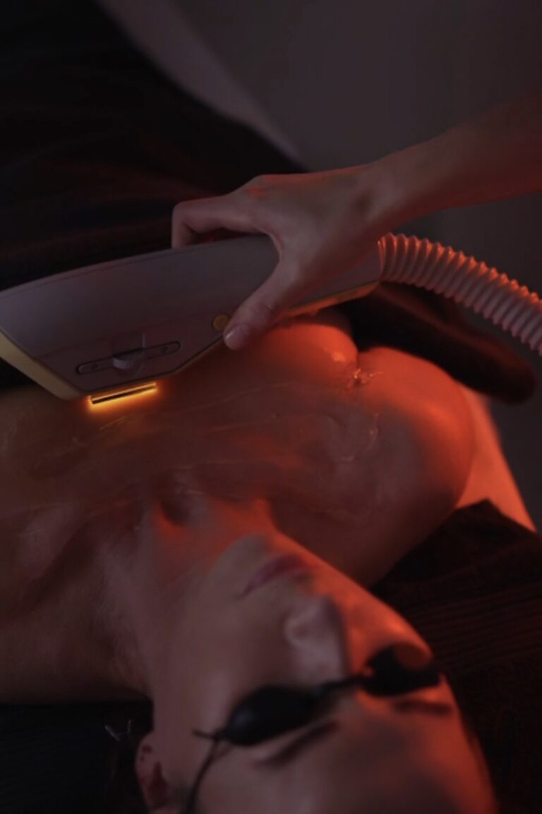 Exilite IPL BTL  Wrocław